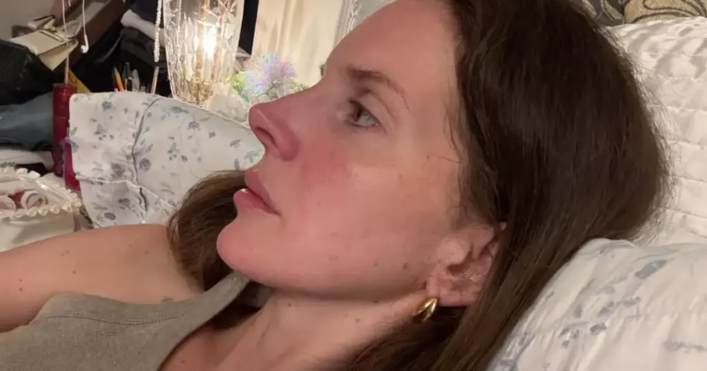 Lana Del Rey: Nisam operisala nos, radila sam samo nehirurško oblikovanje